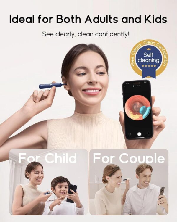 گوش پاک کن هوشمند شیائومی مدل Bebird I35R